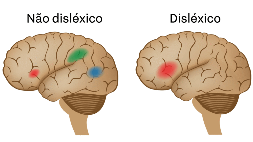 Cérebro-disléxico-1