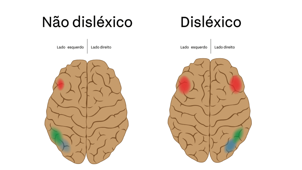 Cérebro-disléxico-2